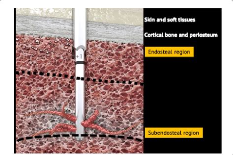 Schematic diagram highlighting the regions within the bone marrow... | Download Scientific Diagram