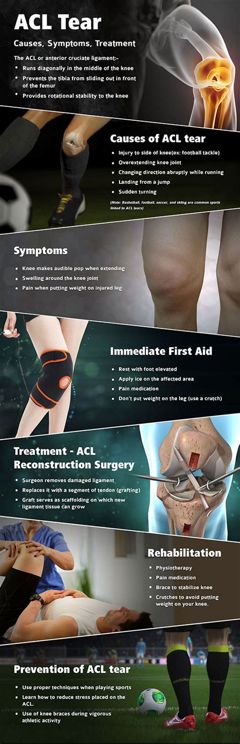 ACL tear – Causes, Symptoms, Treatment | Kauvery Hospital