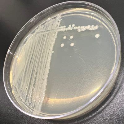 Rhizobium radiobacter | Microchem Laboratory