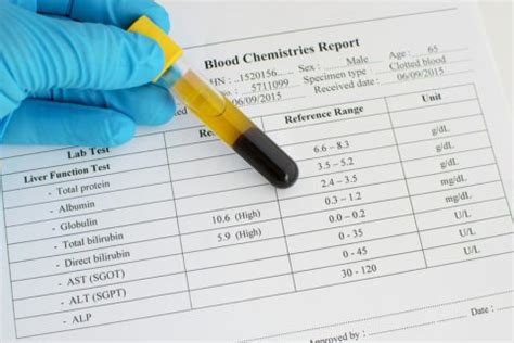 Urobilinogen in Urine: Low & High Levels + Normal Range - SelfDecode Labs