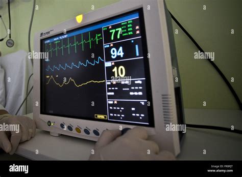 Cardiac monitor showing vital functions of inpatient hospital ICU Stock Photo - Alamy