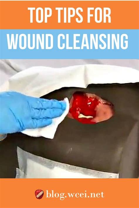 Top Tips for Best Wound Cleansing Practices - WCEI - Blog WCEI – Blog