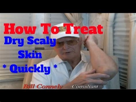 How To Treat Dry Scaly Skin - Quickly - YouTube