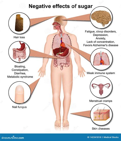 Side Effects of Sugar on the Human Body 3d Medical Illustration Stock ...