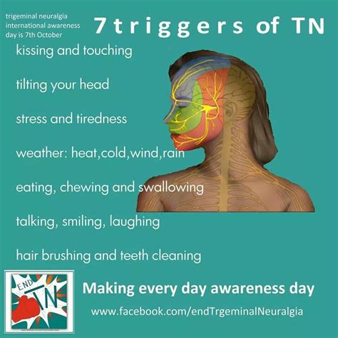 Pin by charlene ranger on ailments. | Trigeminal neuralgia, Neuralgia, Trigeminal neuralgia symptoms