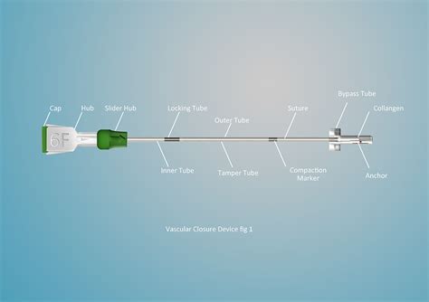 Illustration project | Vascular closure device :: Behance