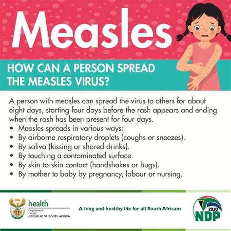 Measles outbreak in WCape, protect your family - Smile 90.4FM