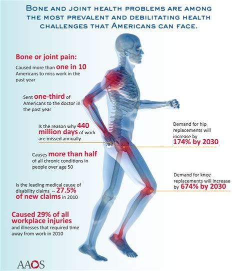 Causes Of Joint Pain And Foods That Relieve Joint Pain What Causes Arthritis, Types Of Arthritis ...