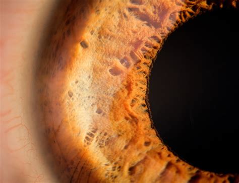 Another eye macro by M4773 on DeviantArt