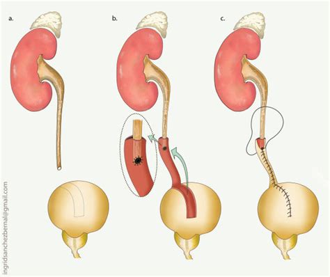 Dr Fam Xeng Inn | Consultant Urology, Laparoscopic and Robotic Surgery