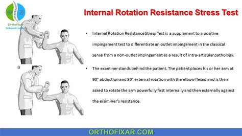 Internal Rotation Resistance Stress Test | OrthoFixar 2024