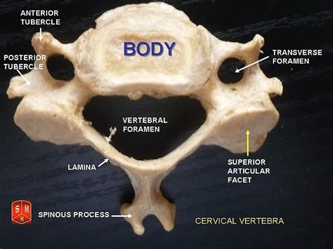 Transverse Foramen Of Cervical Vertebrae