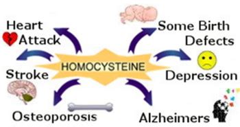 High Homocysteine