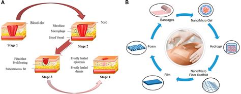 Frontiers | Latest Advances on Bacterial Cellulose-Based Antibacterial Materials as Wound Dressings