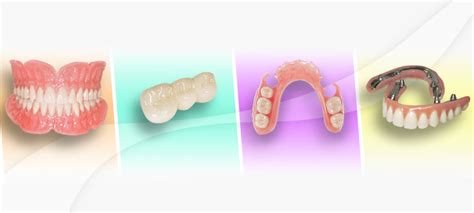 Dental Lab Products | Iverson Dental Lab