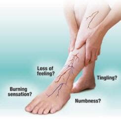 Peripheral Neuropathy Treatment Brisbane | Walk Without Pain