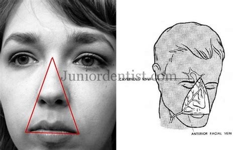 What is Dangerous Area of Face | Dangerous triangle of Face