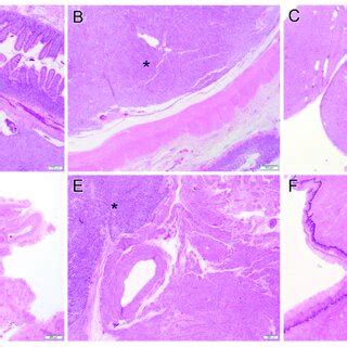 Examples of gastrointestinal stromal tumor histology include sclerosing... | Download Scientific ...