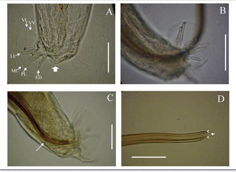 Figure 1 from Angiostrongylus cantonensis and rat lungworm disease in ...