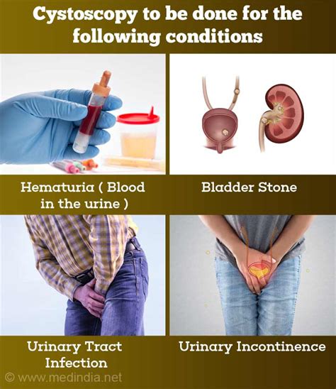 How To Do A Cystoscopy