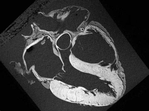 G : ' heart mri scan' | Anatomy art, Digital portrait art, Heart anatomy