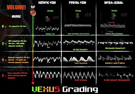 POCUS Spotlight: Perioperative Hemodynamic Assessment in Noncardiac Surgery