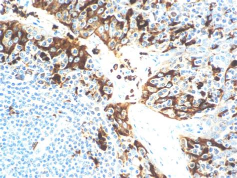 Lysozyme - Rabbit Polyclonal - Bio SB