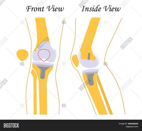 Human Knee Leg Front Image & Photo (Free Trial) | Bigstock