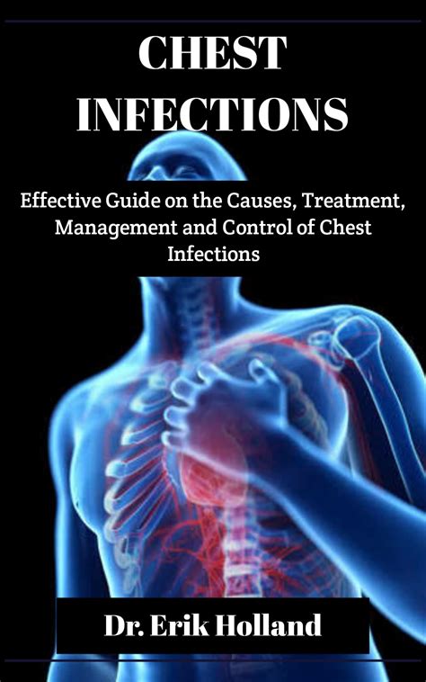 CHEST INFECTIONS: Effective Guide on the Causes, Treatment, Management ...