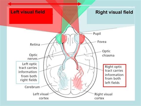 🎉 Split brain patients. Split Brain Patients. 2019-02-22