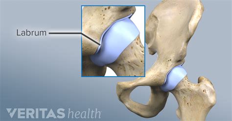 3 Common Hip Injuries | Respire Physical Therapy