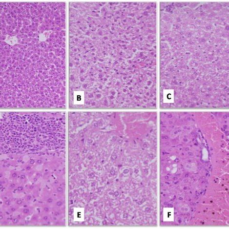 Liver enzymes (ALP, GOT, GPT, GGT) resulted by the LPS challenge and ...