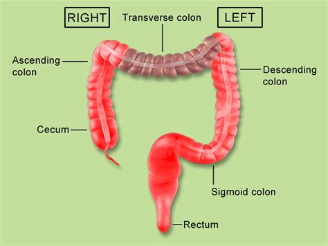 Counting Colorectal Tumors During Flights to Asia