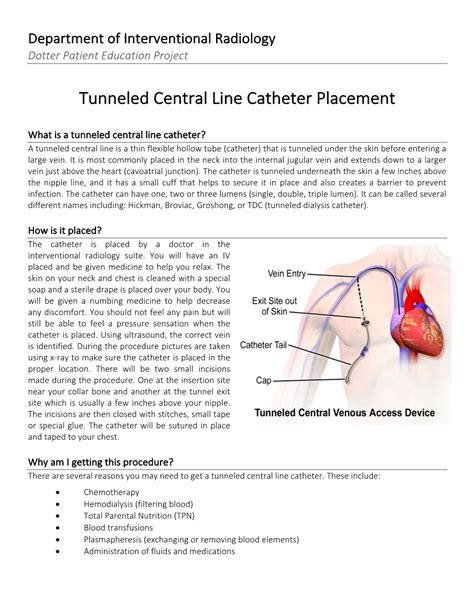 Tunneled Central Line Catheter Placement - DocsLib