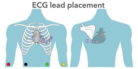 Posterior 12 Lead Ekg Placement Diagram