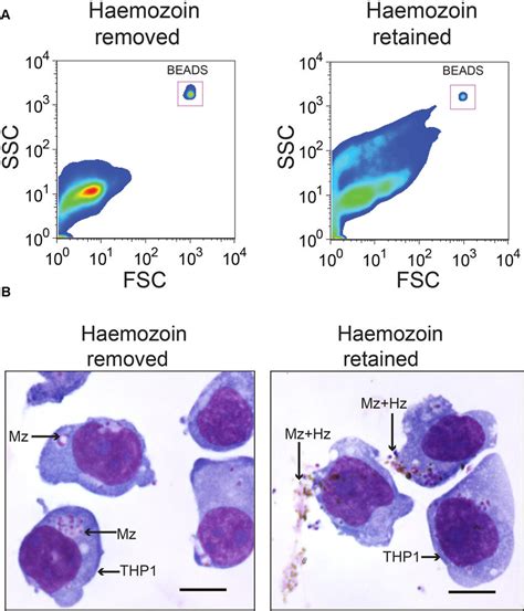 Hemozoin removal is critical to generate a single-cell merozoite... | Download Scientific Diagram