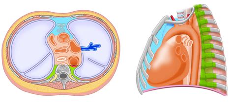 3 Mediastinum and Thymus | Radiology Key