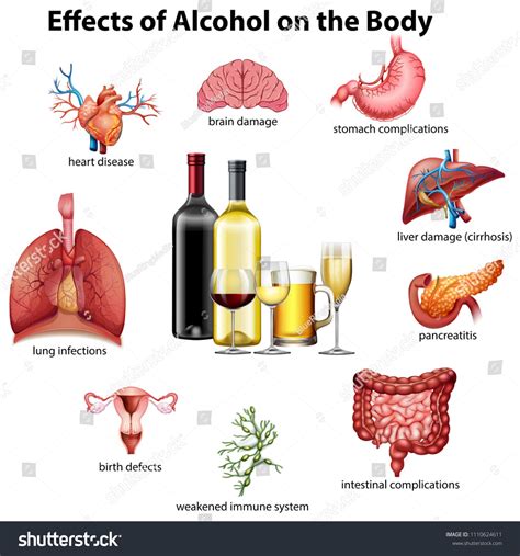 Effects of alcohol on the body illustration #Ad , #affiliate, #alcohol#Effects#illustration#body ...