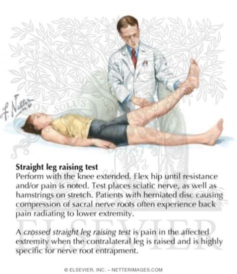 Straight Leg Test