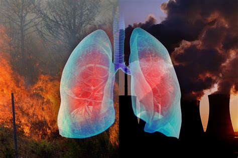 American Lung Association Report Shows 40% of US Regularly Breathes Polluted Air - Pulmonology ...