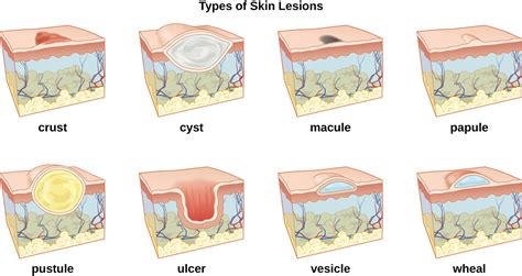 21.1: Anatomy and Normal Microbiota of the Skin and Eyes - Biology LibreTexts