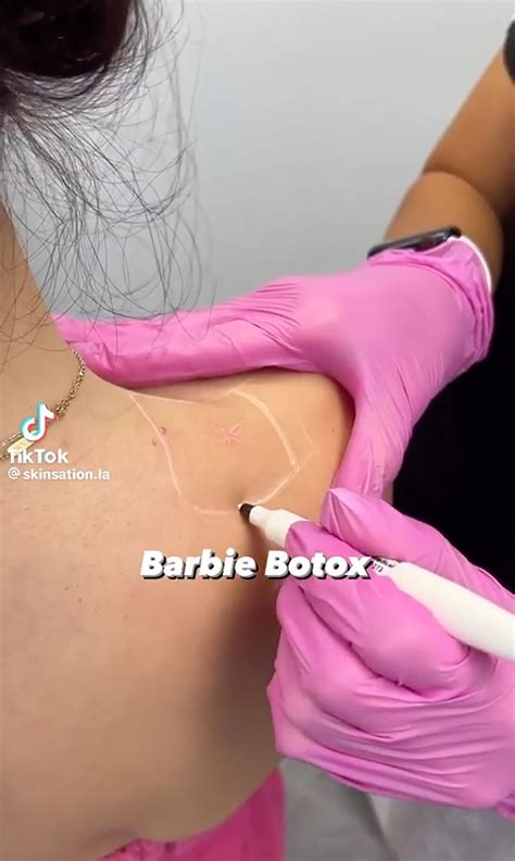 What is ‘Barbie Botox,’ TikTok’s latest beauty obsession? | CNN