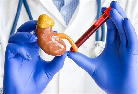 Creatinine Blood Test: Levels and Normal Range