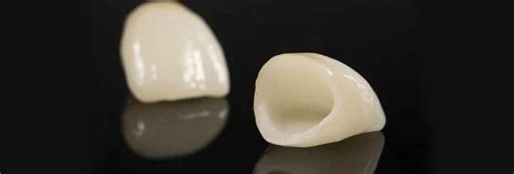 Porcelain - Dental Smiles