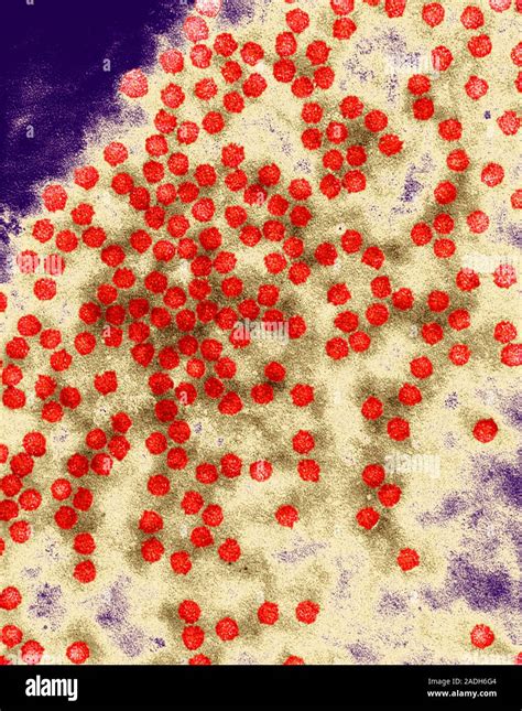 Cucumber mosaic virus. Coloured transmission electron micrograph (TEM) of virus particles ...