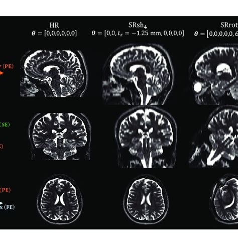 FIGURE Examples of intensity-normalized acquired MS images: views from ...