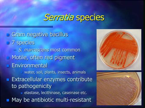 Bacillus species antibiotic treatment