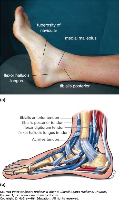 Ankle pain | Brukner & Khan’s Clinical Sports Medicine: Injuries ...