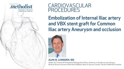 Embolization of Internal Iliac artery & VBX stent graft for Common Iliac artery Aneurysm ...