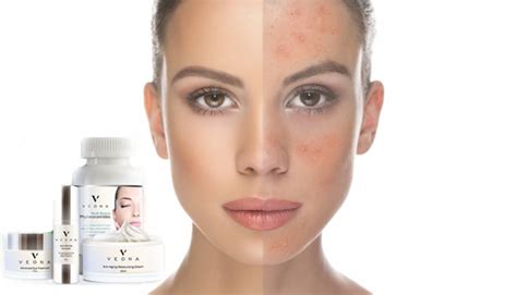 Veona Anti Aging Cream Reviews: Veona Beauty Official Website & Price